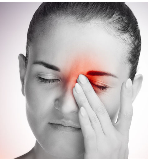 What Are Ocular Migraine Headaches ?