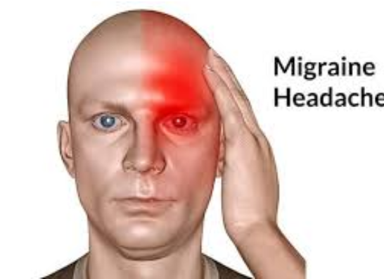 What Are The Natural Remedies for Migraines ?